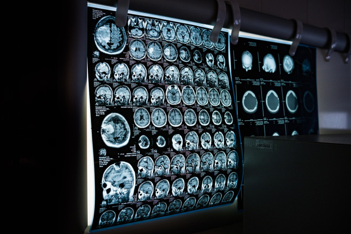 Advanced imaging and diagnostics